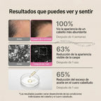 Comparación visual posterior del cabello antes y después de 12 semanas de uso del Shampoo PDRN Magic Hair